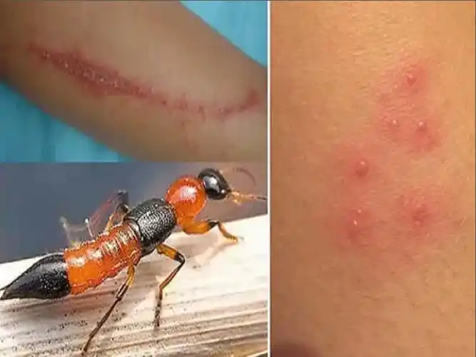 爬到身上千万别拍,它真的很毒 _光明网