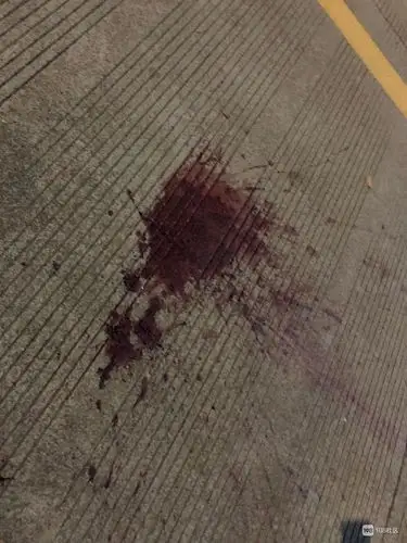 马路中间竟然有一滩血