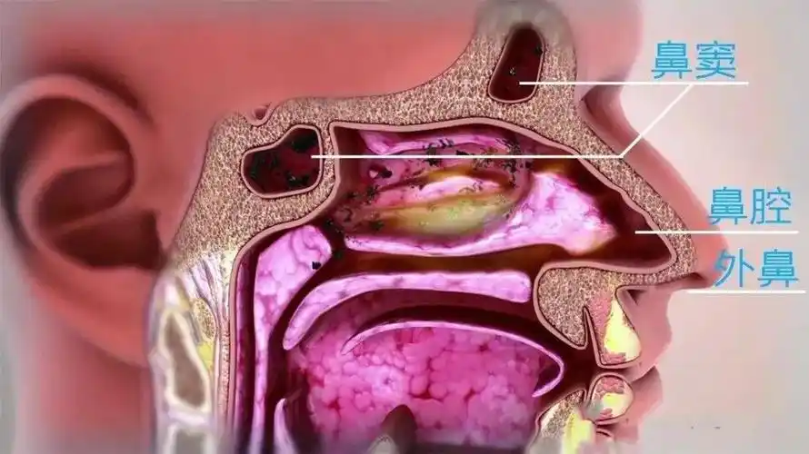 鼻子和眼睛到底有什么关系这要先从鼻腔特殊的结构说起,鼻由外鼻,鼻腔