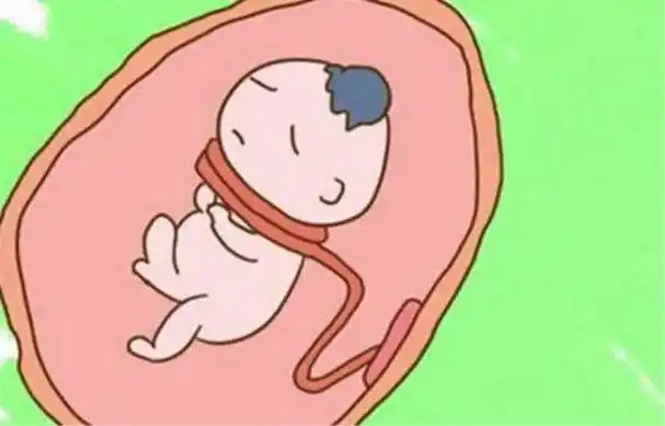 没有脐带绕颈时报告单上会写"胎儿颈部未见压迹".