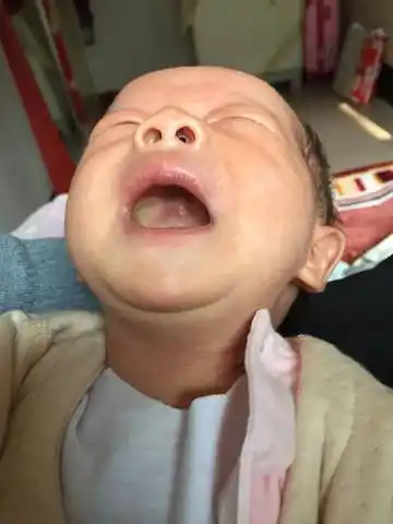 我家宝宝二十二天,这两天哭闹厉害,刚哭的时候看见上颚有白点,上网查