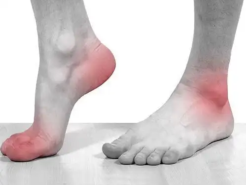 痛风石切除就可以一劳永逸了吗怎么防止痛风石再生长