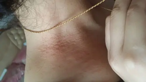 麻麻脖子上边忽然上的这个!有没有人认识啊!这是怎么了!