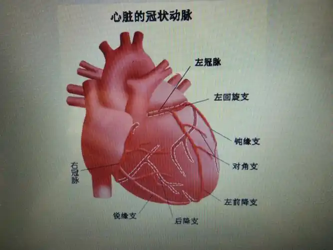 兴安盟人民医院心内二科 科普之一 冠脉支架到底是什么"鬼"