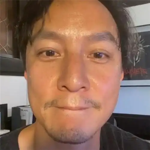 吴彦祖盲肠炎复发紧急入院,憔悴病床照曝光,已手术开刀切除