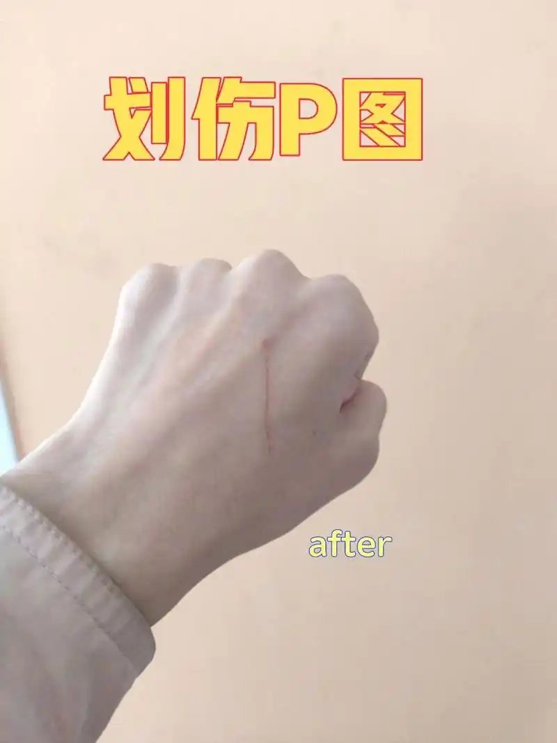 美图秀秀伤口p图简直太好用啦 只是浅浅用修容笔p了一下,如果想要更