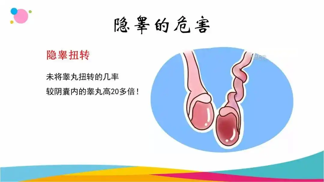 唯爱儿科行科普月月讲儿童隐睾迷失的蛋蛋