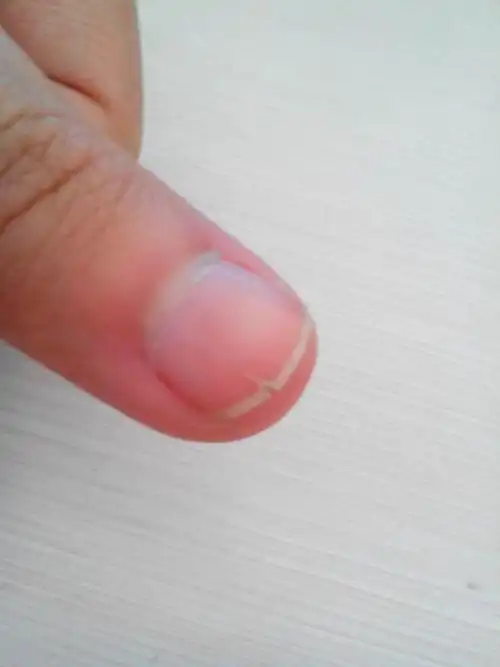 大拇指指甲裂开.每次剪了长长了就会自己裂