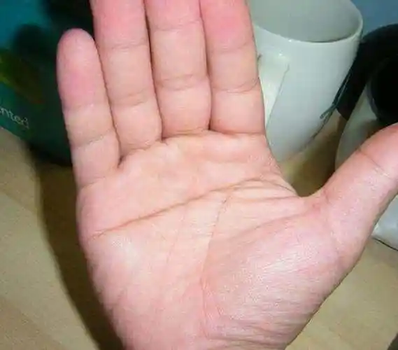 7个世界罕见的人体特征,只有少数人拥有,你会是天选之子吗?