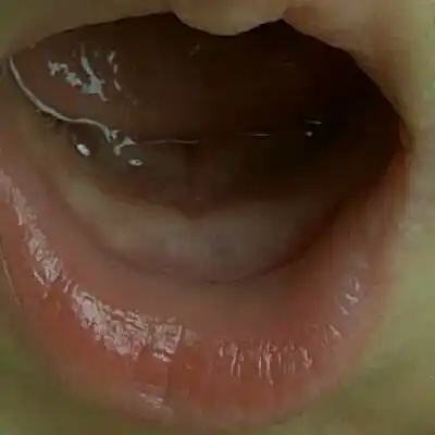 宝宝半岁了,牙床已经白了一个多月了,今天突然看到宝宝长牙的地方成