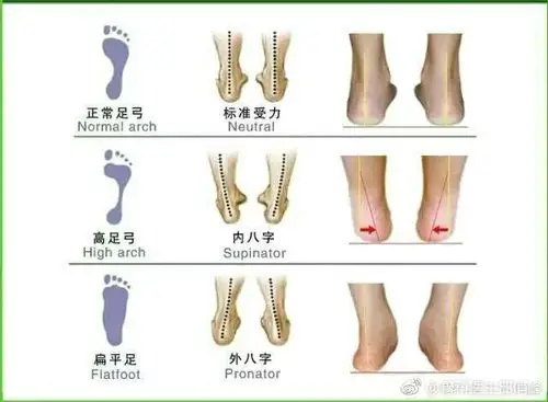 治疗平足症的终极武器