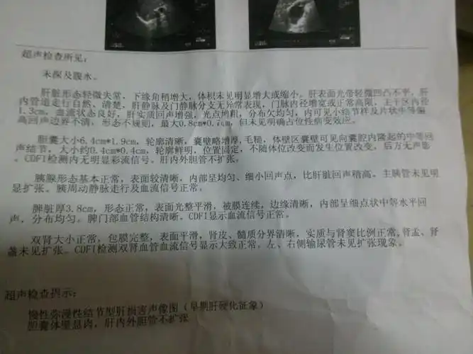 2013-11-10 盛全城 医师 大三阳经治疗三年后转为乙肝小二阳已一年