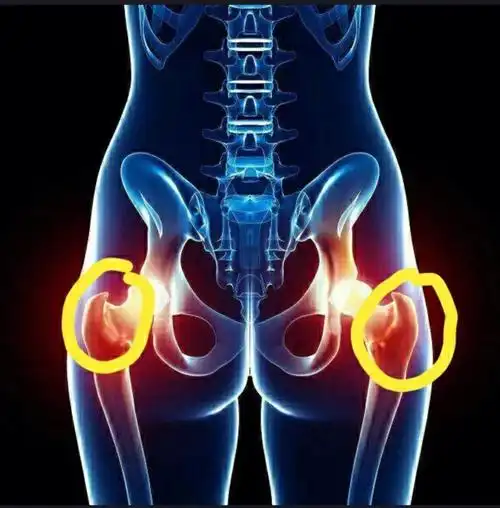 记33周耻骨痛胯骨轴疼附缓解方法