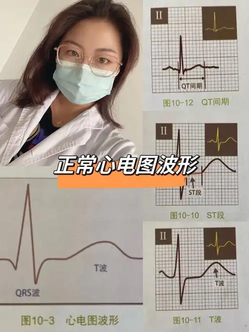 学习心电图之正常心电图波形