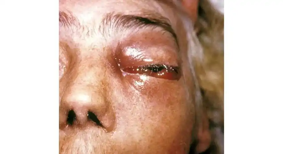 你爱的腐乳里,少不了这个神奇的小东西