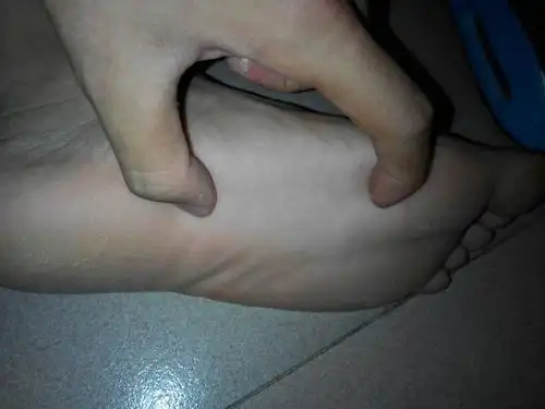 脚底这个部分的脚底筋每次运动后都很痛