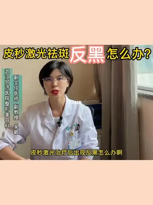 皮秒激光祛斑反黑怎么办