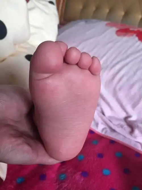 小朋友平底足家里有遗传宝爸就是平底足