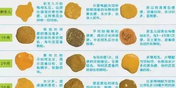 婴儿大便常识图解,警惕便便发出的危险信号