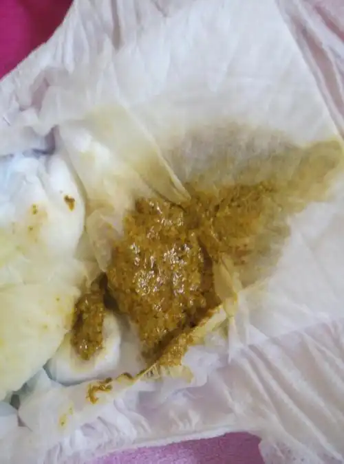 有医生在吗 新生儿的大便是这种颜色正常吗 之前是黄色的 - 百度宝宝