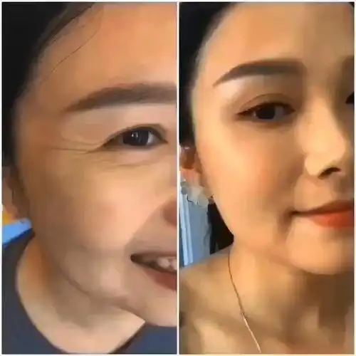 细胞之家焕颜花皇鱼尾纹三天对比