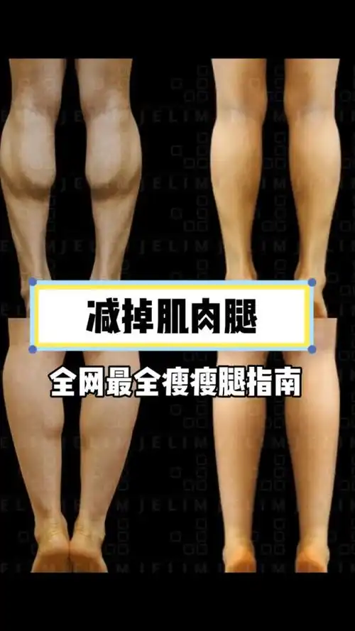 腓肠肌发达