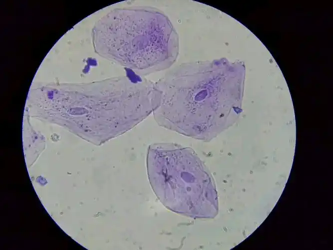 口腔上皮细胞(龙胆紫染色),洋葱透明侧表皮细胞(龙胆紫染色),洋葱紫色