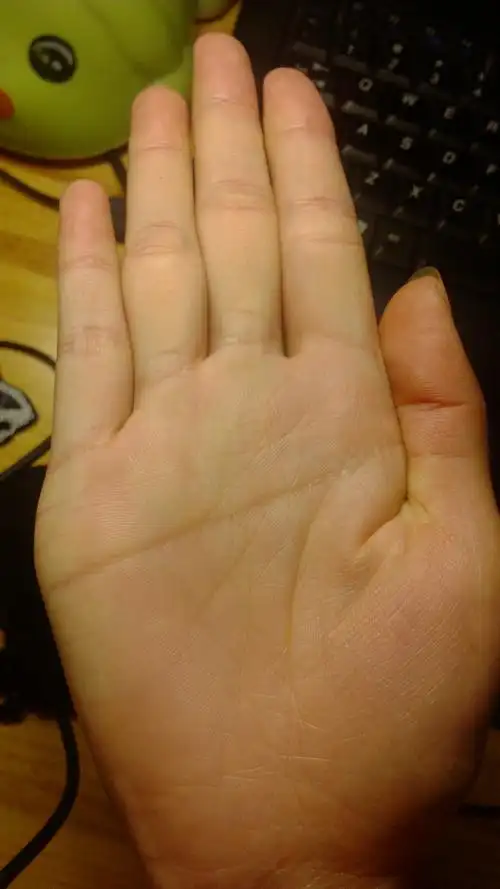 女孩,右手断手纹幼年不幸一直都不是很顺利.想看一下以后的运势