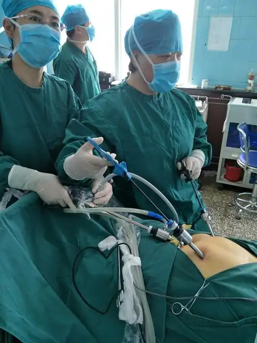 妇产科完成一例腔镜下卵巢囊肿切除术
