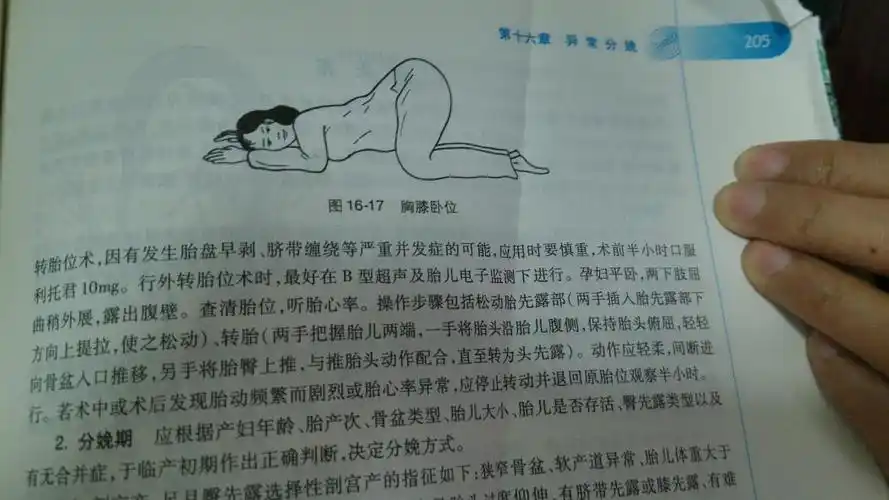 一周后复查应该有用!我今天查也是头右脚左横位!医生说要我这样!