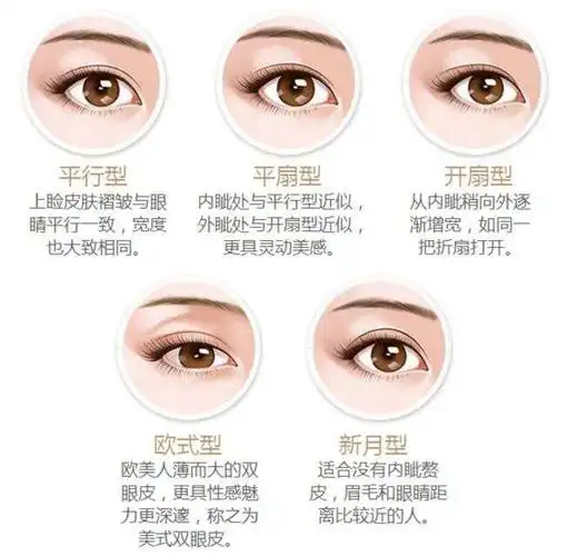 请问我这种眼睛需要做哪种类型的双眼皮?