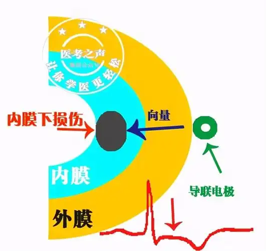 星医百学习心电图这是我见过最牛的文章