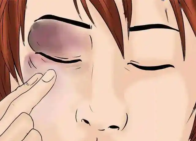 健康在身边丨眼部受到意外伤害应如何处理