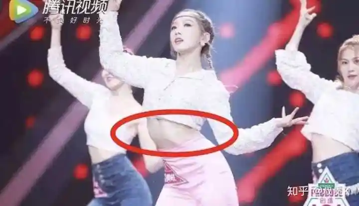 肋骨外翻可以有好身材么