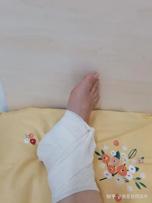 脚踝骨折记录贴