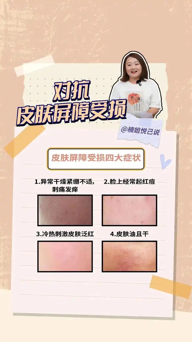 皮肤屏障受损   皮肤屏障受损四大症状你 - 抖音