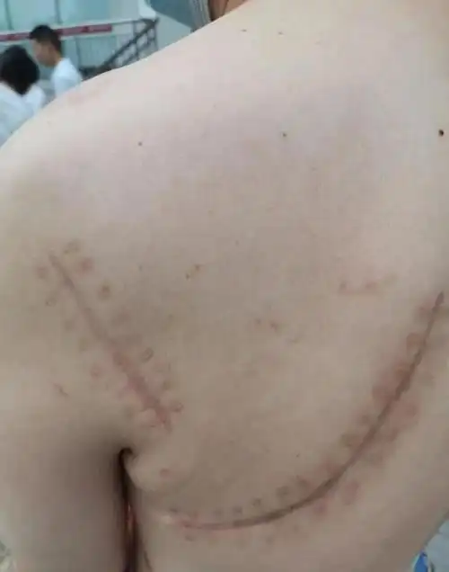 因钟科申请工伤认定时卡在一纸"交通事故认定书"上,此事曾引发媒体