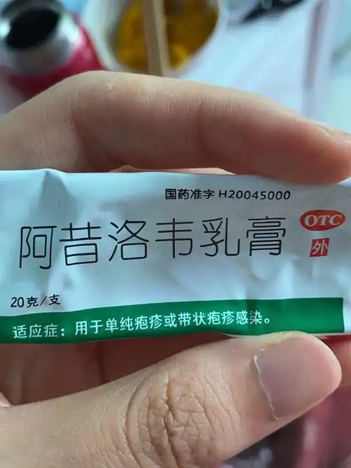 9925岁成年人 居然还是出了水痘6015我的症状:day1:洗澡时发现