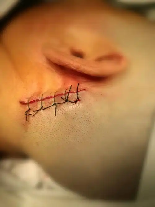 灵寿人民注意啦!左眼跳财,右眼跳灾,是真的吗?