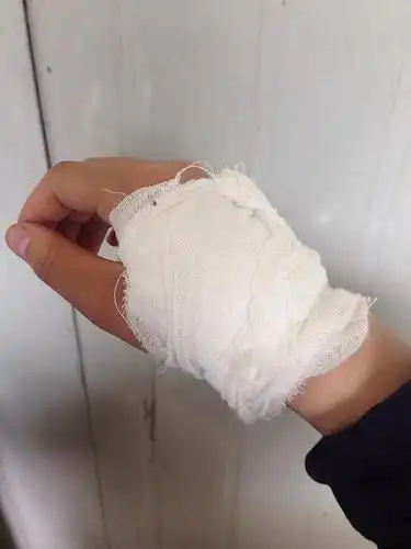 昨天,给我包扎伤口的男护士长的挺帅的