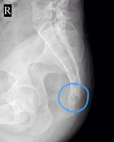 人的尾巴断了该怎么办