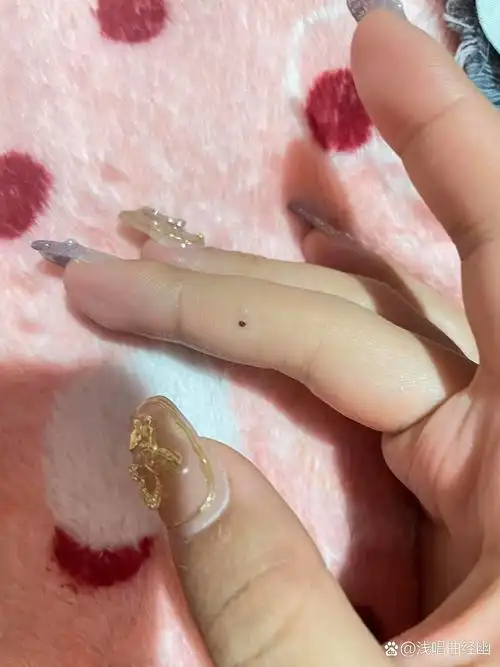 右手中指突然长痣  有什么寓意吗,或者🤔其他什么嘛