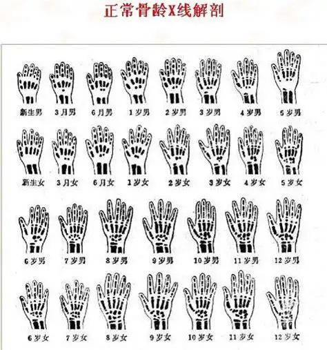 女孩11岁,骨龄12岁,还可以长高多少