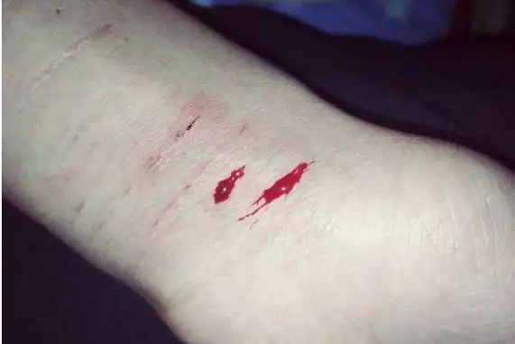 小学是学霸初中第5名就自残不要把孩子培养成自己讨厌的样子