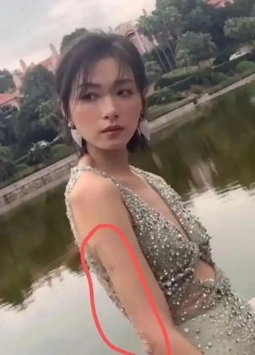 万茜车祸伤口曝光工作室首次回应却遭质疑