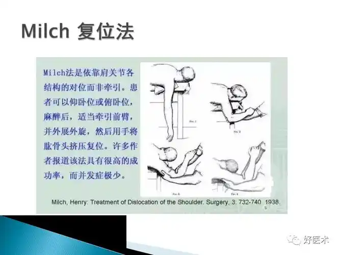 早读| 肩关节脱位的复位方法,最全汇总!