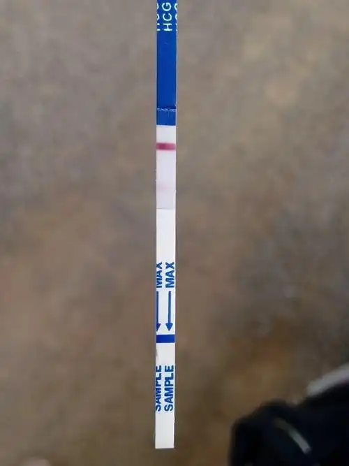 满意回答 如果是两条红线,颜色一样深的话,说明是怀孕了,如果是一深