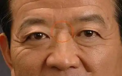 什么是印堂八字纹,图文解读印堂八字纹