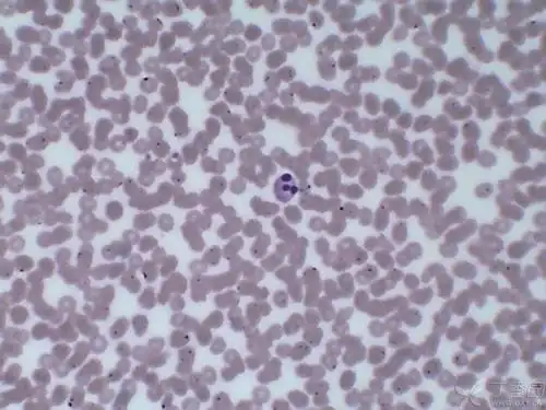 其他红细胞上的紫色小点,是染料附着.