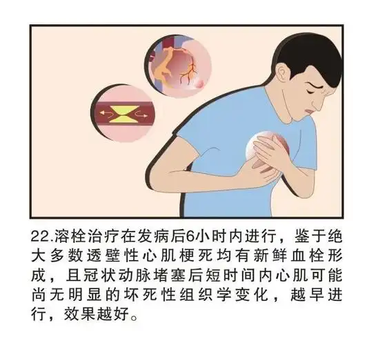 图解疾病急性心肌梗塞